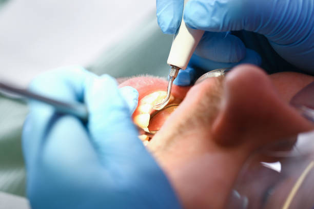 Best Broken or Chipped Tooth Repair in South Bound Brook, NJ